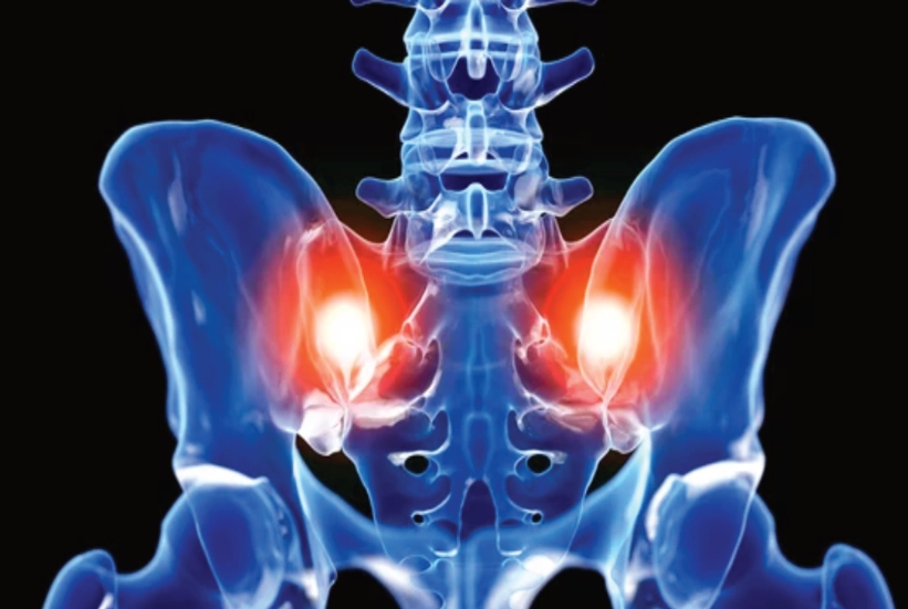 Sacroiliac Joint Dysfunctions