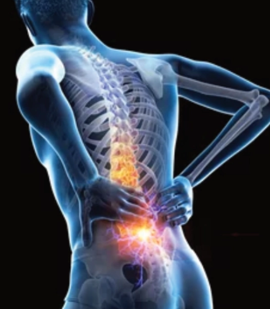 Chronic Back Pain