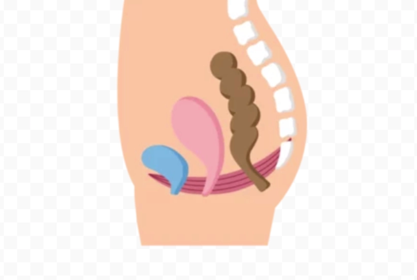Physiotherapy for Urinary Incontinence