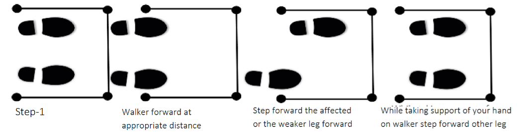 Hip Replacement Recovery Guide