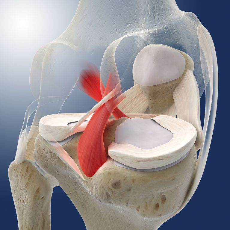 Sprain vs. Strain: Understanding the Difference